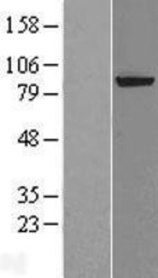 Western Blot: XPD Overexpression Lysate (Adult Normal) [NBL1-10320] Left-Empty vector transfected control cell lysate (HEK293 cell lysate); Right -Over-expression Lysate for XPD.