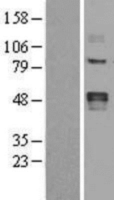 Western Blot: LOX Overexpression Lysate (Adult Normal) [NBL1-12640] - Left - Empty vector transfected control cell lysate (HEK293 cell lysate); Right - Over-expression Lysate for LOX.