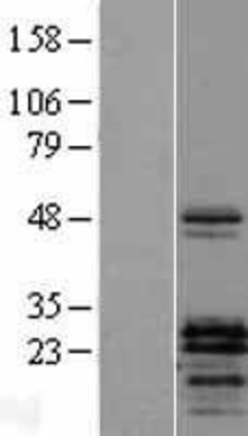 Western Blot: PTHLH Overexpression Lysate (Adult Normal) [NBL1-14948] Left-Empty vector transfected control cell lysate (HEK293 cell lysate); Right -Over-expression Lysate for PTHLH.