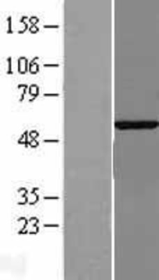 Western Blot: G3BP2 Overexpression Lysate (Adult Normal) [NBL1-10896] Left-Empty vector transfected control cell lysate (HEK293 cell lysate); Right -Over-expression Lysate for G3BP2.