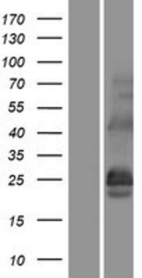 Western Blot: CSP Overexpression Lysate (Adult Normal) [NBP2-11584] Left-Empty vector transfected control cell lysate (HEK293 cell lysate); Right -Over-expression Lysate for CSP.