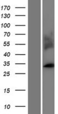 Western Blot: MARCH1 Overexpression Lysate (Adult Normal) [NBP2-11467] Left-Empty vector transfected control cell lysate (HEK293 cell lysate); Right -Over-expression Lysate for MARCH1.