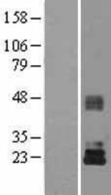 Western Blot: TIMP3 Overexpression Lysate (Adult Normal) [NBL1-16926] Left-Empty vector transfected control cell lysate (HEK293 cell lysate); Right -Over-expression Lysate for TIMP3.