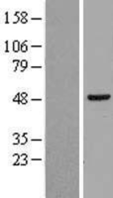 Western Blot: hHR23b Overexpression Lysate (Adult Normal) [NBL1-15115] Left-Empty vector transfected control cell lysate (HEK293 cell lysate); Right -Over-expression Lysate for hHR23b.