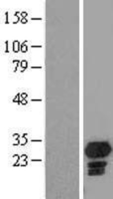 Western Blot: CHMP5 Overexpression Lysate (Adult Normal) [NBL1-09162] Left-Empty vector transfected control cell lysate (HEK293 cell lysate); Right -Over-expression Lysate for CHMP5.