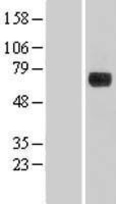 Western Blot: DENND1A Overexpression Lysate (Adult Normal) [NBL1-09827] Left-Empty vector transfected control cell lysate (HEK293 cell lysate); Right -Over-expression Lysate for DENND1A.