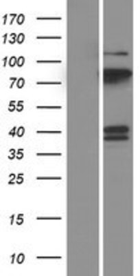 Western Blot: PCPTP1 Overexpression Lysate (Adult Normal) [NBP2-11323] Left-Empty vector transfected control cell lysate (HEK293 cell lysate); Right -Over-expression Lysate for PCPTP1.
