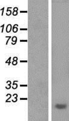 Western Blot: Aprataxin Overexpression Lysate (Adult Normal) [NBP2-06938] Left-Empty vector transfected control cell lysate (HEK293 cell lysate); Right -Over-expression Lysate for Aprataxin.