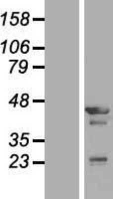 Western Blot: Tropomodulin 3 Overexpression Lysate (Adult Normal) [NBL1-17117] Left-Empty vector transfected control cell lysate (HEK293 cell lysate); Right -Over-expression Lysate for Tropomodulin 3.
