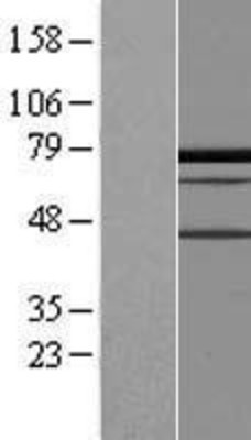 Western Blot: PALMD Overexpression Lysate (Adult Normal) [NBL1-14089] Left-Empty vector transfected control cell lysate (HEK293 cell lysate); Right -Over-expression Lysate for PALMD.