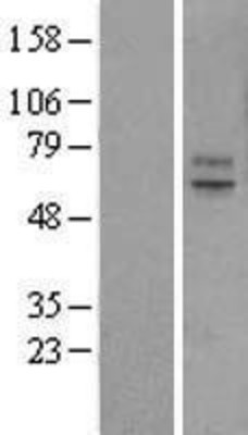 Western Blot: ABCG2 Overexpression Lysate (Adult Normal) [NBL1-07187] Left-Empty vector transfected control cell lysate (HEK293 cell lysate); Right -Over-expression Lysate for ABCG2.