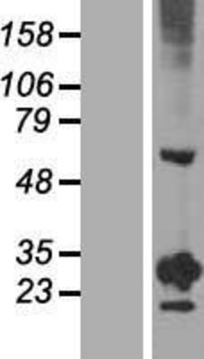 Western Blot: RGS20 Overexpression Lysate (Adult Normal) [NBL1-15328] Left-Empty vector transfected control cell lysate (HEK293 cell lysate); Right -Over-expression Lysate for RGS20.