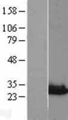 Western Blot: NIPSNAP3A Overexpression Lysate (Adult Normal) [NBL1-13646] Left-Empty vector transfected control cell lysate (HEK293 cell lysate); Right -Over-expression Lysate for NIPSNAP3A.