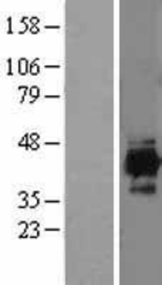 Western Blot: IDH3A Overexpression Lysate (Adult Normal) [NBL1-11819] Left-Empty vector transfected control cell lysate (HEK293 cell lysate); Right -Over-expression Lysate for IDH3A.