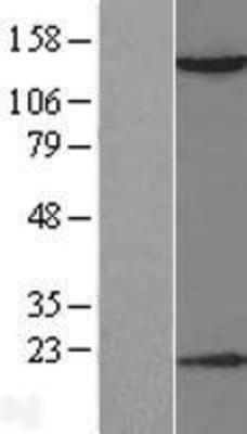 Western Blot: HDAC6 Overexpression Lysate (Adult Normal) [NBL1-11484] Left-Empty vector transfected control cell lysate (HEK293 cell lysate); Right -Over-expression Lysate for HDAC6.