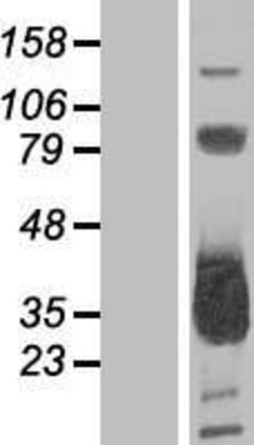 Western Blot: MMACHC Overexpression Lysate (Adult Normal) [NBL1-13144] Left-Empty vector transfected control cell lysate (HEK293 cell lysate); Right -Over-expression Lysate for MMACHC.