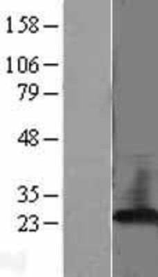 Western Blot: PBP Overexpression Lysate (Adult Normal) [NBL1-14274] Left-Empty vector transfected control cell lysate (HEK293 cell lysate); Right -Over-expression Lysate for PBP.