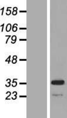 Western Blot: MPST Overexpression Lysate (Adult Normal) [NBL1-13209] Left-Empty vector transfected control cell lysate (HEK293 cell lysate); Right -Over-expression Lysate for MPST.