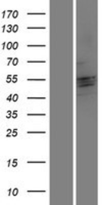 Western Blot: CRISPLD2 Overexpression Lysate (Adult Normal) [NBP2-06117] Left-Empty vector transfected control cell lysate (HEK293 cell lysate); Right -Over-expression Lysate for CRISPLD2.