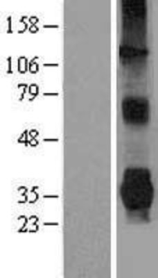 Western Blot: Parkin Overexpression Lysate (Adult Normal) [NBL1-14105] Left-Empty vector transfected control cell lysate (HEK293 cell lysate); Right -Over-expression Lysate for Parkin.