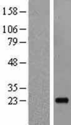 Western Blot: IL19 Overexpression Lysate (Adult Normal) [NBL1-11921] Left-Empty vector transfected control cell lysate (HEK293 cell lysate); Right -Over-expression Lysate for IL19.