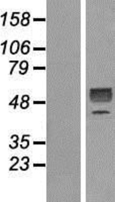 Western Blot: GDF 9 Overexpression Lysate (Adult Normal) [NBP2-10477] Left-Empty vector transfected control cell lysate (HEK293 cell lysate); Right -Over-expression Lysate for GDF 9.