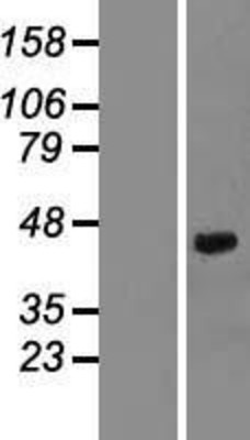 Western Blot: Decorin Overexpression Lysate (Adult Normal) [NBP2-10784] Left-Empty vector transfected control cell lysate (HEK293 cell lysate); Right -Over-expression Lysate for Decorin.