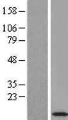 Western Blot: ROBLD3 Overexpression Lysate (Adult Normal) [NBL1-12864] Left-Empty vector transfected control cell lysate (HEK293 cell lysate); Right -Over-expression Lysate for ROBLD3.