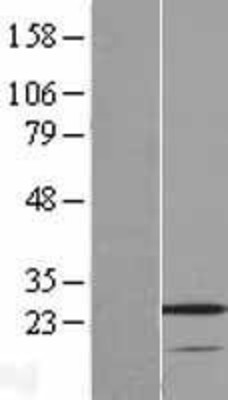 Western Blot: VSTM2A Overexpression Lysate (Adult Normal) [NBL1-17765] Left-Empty vector transfected control cell lysate (HEK293 cell lysate); Right -Over-expression Lysate for VSTM2A.