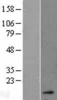 Western Blot: Hemoglobin A2 Overexpression Lysate (Adult Normal) [NBL1-11455] Left-Empty vector transfected control cell lysate (HEK293 cell lysate); Right -Over-expression Lysate for Hemoglobin A2.