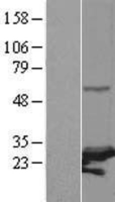Western Blot: PSMC3IP Overexpression Lysate (Adult Normal) [NBL1-14889] Left-Empty vector transfected control cell lysate (HEK293 cell lysate); Right -Over-expression Lysate for PSMC3IP.