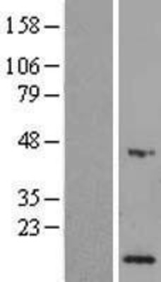 Western Blot: SEPHS1 Overexpression Lysate (Adult Normal) [NBL1-15814] Left-Empty vector transfected control cell lysate (HEK293 cell lysate); Right -Over-expression Lysate for SEPHS1.