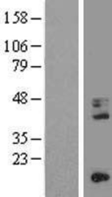 Western Blot: CD68 Overexpression Lysate (Adult Normal) [NBL1-08962] Left-Empty vector transfected control cell lysate (HEK293 cell lysate); Right -Over-expression Lysate for CD68.