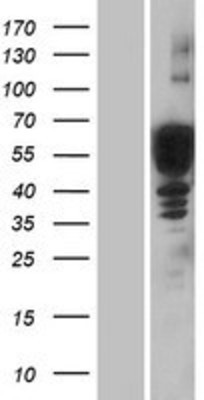 Western Blot: Doublecortin Overexpression Lysate (Adult Normal) [NBP2-10681] Left-Empty vector transfected control cell lysate (HEK293 cell lysate); Right -Over-expression Lysate for Doublecortin.