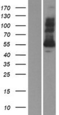 Western Blot: Glutathione Reductase Overexpression Lysate (Adult Normal) [NBP2-10688] Left-Empty vector transfected control cell lysate (HEK293 cell lysate); Right -Over-expression Lysate for Glutathione Reductase.