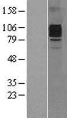 Western Blot: GCSF Receptor Overexpression Lysate (Adult Normal) [NBP2-10706] Left-Empty vector transfected control cell lysate (HEK293 cell lysate); Right -Over-expression Lysate for GCSF Receptor.