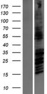 Western Blot: NMDAR2B Overexpression Lysate (Adult Normal) [NBP2-10711] Left-Empty vector transfected control cell lysate (HEK293 cell lysate); Right -Over-expression Lysate for NMDAR2B.