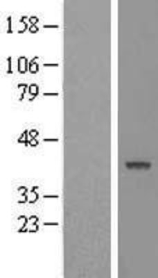Western Blot: PTPN2 Overexpression Lysate (Adult Normal) [NBL1-14972] Left-Empty vector transfected control cell lysate (HEK293 cell lysate); Right -Over-expression Lysate for PTPN2.