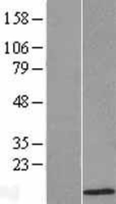 Western Blot: ATOX1 Overexpression Lysate (Adult Normal) [NBL1-07805] Left-Empty vector transfected control cell lysate (HEK293 cell lysate); Right -Over-expression Lysate for ATOX1.