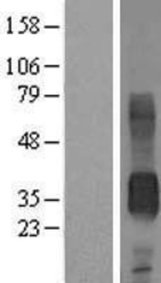 Western Blot: CD7 Overexpression Lysate (Adult Normal) [NBL1-08964] Left-Empty vector transfected control cell lysate (HEK293 cell lysate); Right -Over-expression Lysate for CD7.