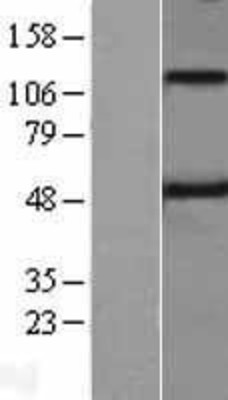 Western Blot: Spinesin Overexpression Lysate (Adult Normal) [NBL1-17126] Left-Empty vector transfected control cell lysate (HEK293 cell lysate); Right -Over-expression Lysate for Spinesin.
