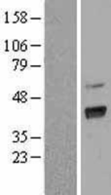 Western Blot: GNAI3 Overexpression Lysate (Adult Normal) [NBL1-11157] Left-Empty vector transfected control cell lysate (HEK293 cell lysate); Right -Over-expression Lysate for GNAI3.