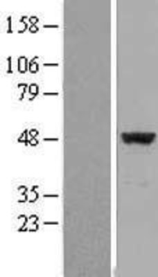 Western Blot: eIF4A2 Overexpression Lysate (Adult Normal) [NBL1-10202] Left-Empty vector transfected control cell lysate (HEK293 cell lysate); Right -Over-expression Lysate for eIF4A2.