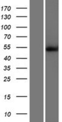 Western Blot: CaMKII delta Overexpression Lysate (Adult Normal) [NBP2-05195] Left-Empty vector transfected control cell lysate (HEK293 cell lysate); Right -Over-expression Lysate for CaMKII delta.