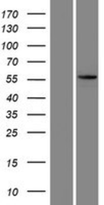 Western Blot: KRT73 Overexpression Lysate (Adult Normal) [NBP2-05076] Left-Empty vector transfected control cell lysate (HEK293 cell lysate); Right -Over-expression Lysate for KRT73.