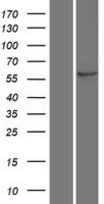 Western Blot: CaMKII beta Overexpression Lysate (Adult Normal) [NBP2-05191] Left-Empty vector transfected control cell lysate (HEK293 cell lysate); Right -Over-expression Lysate for CaMKII beta.