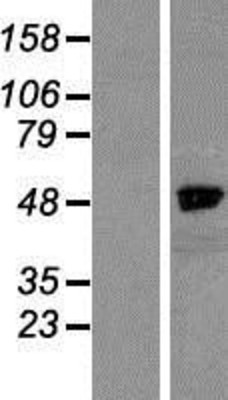 Western Blot: NCKAP1 Overexpression Lysate (Adult Normal) [NBP2-07394] Left-Empty vector transfected control cell lysate (HEK293 cell lysate); Right -Over-expression Lysate for NCKAP1.