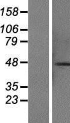 Western Blot: CCDC113 Overexpression Lysate (Adult Normal) [NBP2-07375] Left-Empty vector transfected control cell lysate (HEK293 cell lysate); Right -Over-expression Lysate for CCDC113.