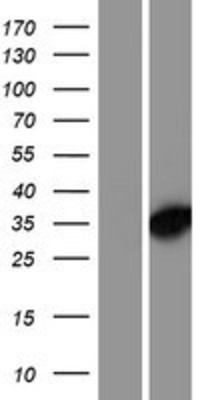 Western Blot: DNAJC8 Overexpression Lysate (Adult Normal) [NBP2-07360] Left-Empty vector transfected control cell lysate (HEK293 cell lysate); Right -Over-expression Lysate for DNAJC8.