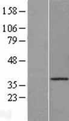 Western Blot: Cathepsin O Overexpression Lysate (Adult Normal) [NBL1-09597] Left-Empty vector transfected control cell lysate (HEK293 cell lysate); Right -Over-expression Lysate for Cathepsin O.